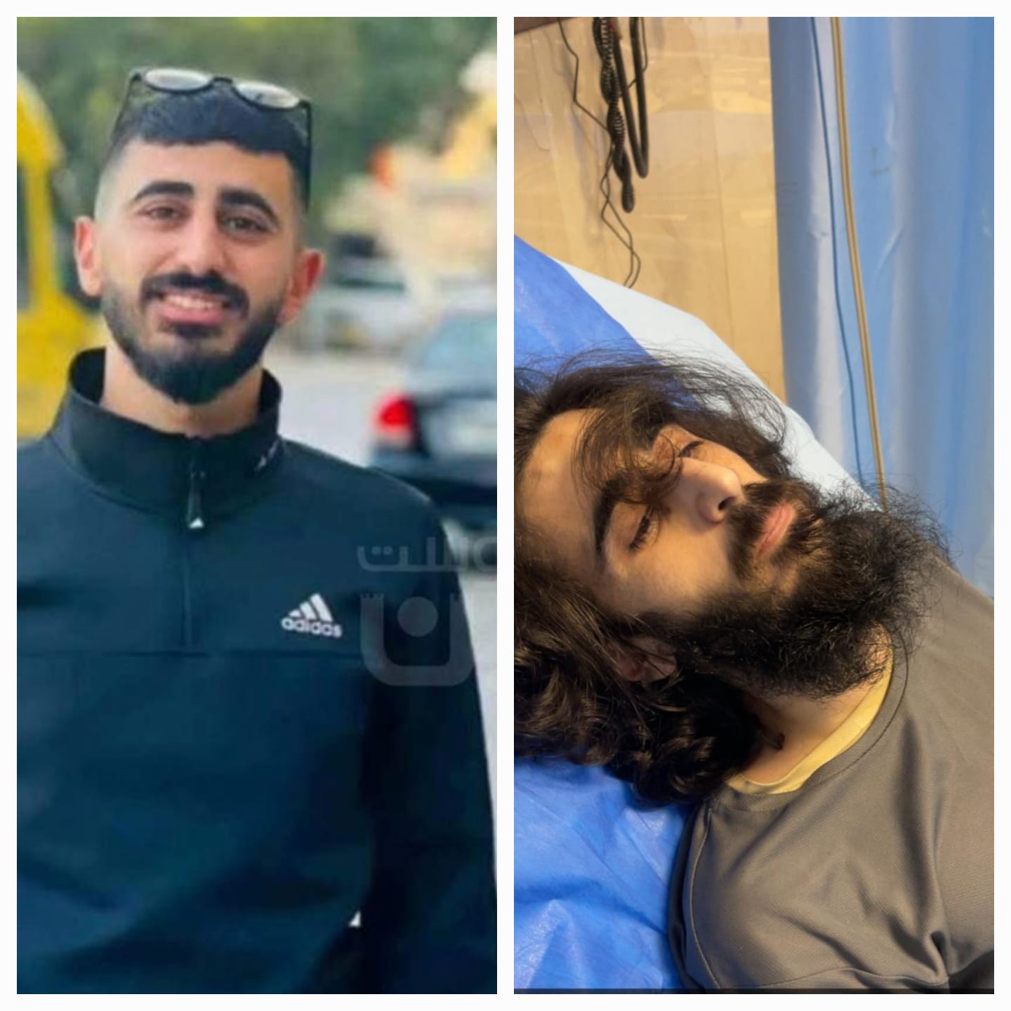Freed Palestinian Detainee Hospitalized due to Severe Physical Assault During Release